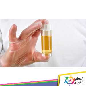 طرق علاج صديد البول عند الاطفال