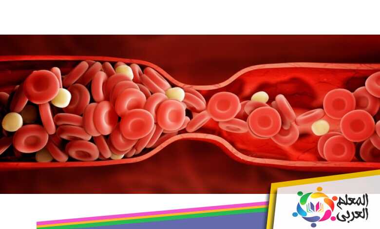 ما هي اعراض الجلطة عند الشباب وطرق علاجها